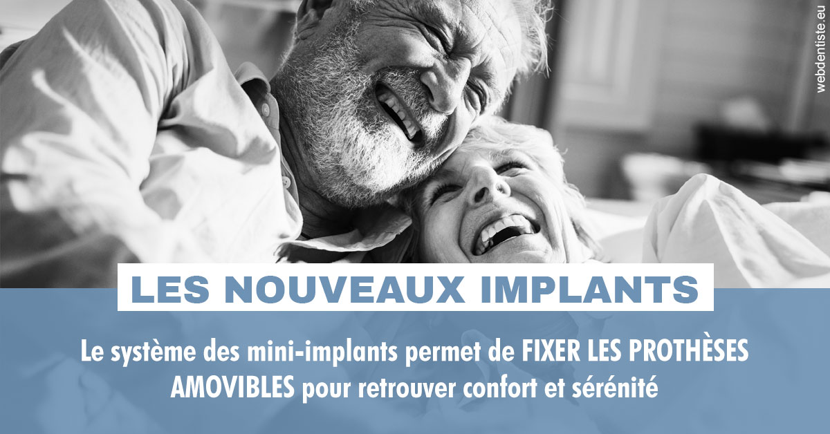 https://selarl-ercd.chirurgiens-dentistes.fr/Les nouveaux implants 2