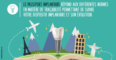 https://selarl-ercd.chirurgiens-dentistes.fr/Le passeport implantaire