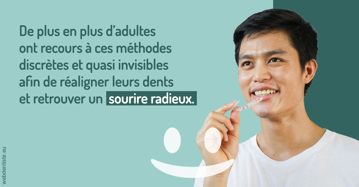 https://selarl-ercd.chirurgiens-dentistes.fr/Gouttières sourire radieux 2