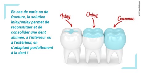 https://selarl-ercd.chirurgiens-dentistes.fr/L'INLAY ou l'ONLAY