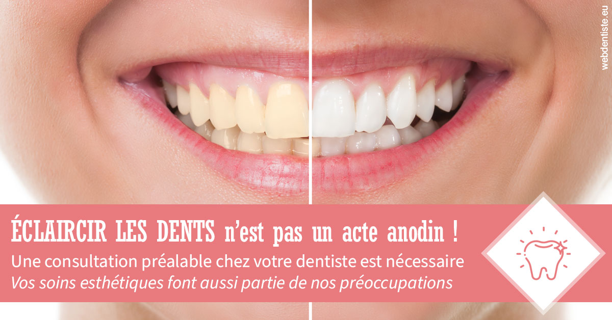 https://selarl-ercd.chirurgiens-dentistes.fr/Eclaircir les dents 1