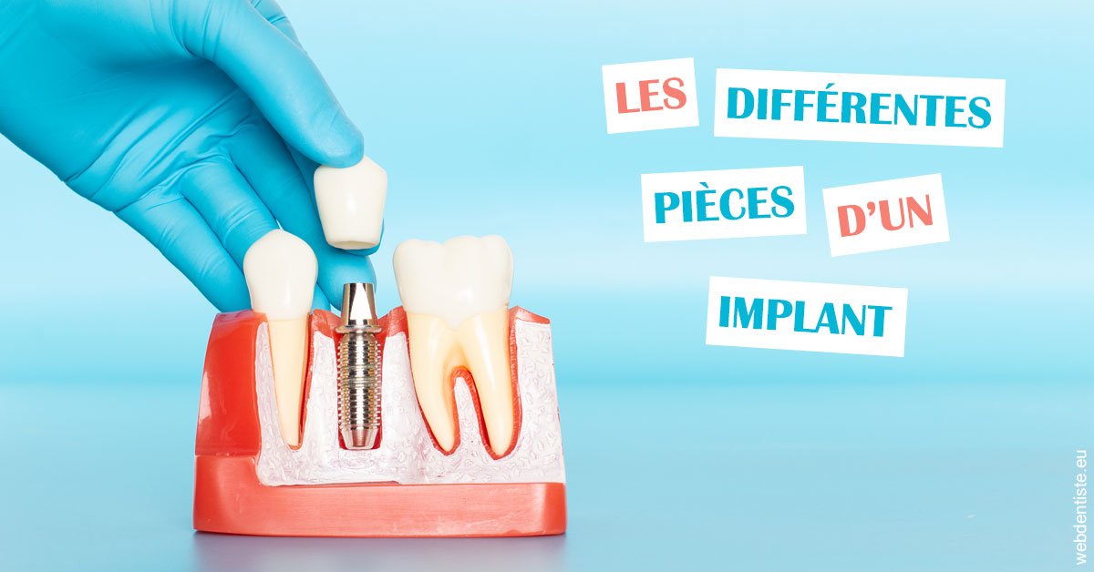 https://selarl-ercd.chirurgiens-dentistes.fr/Les différentes pièces d’un implant 2
