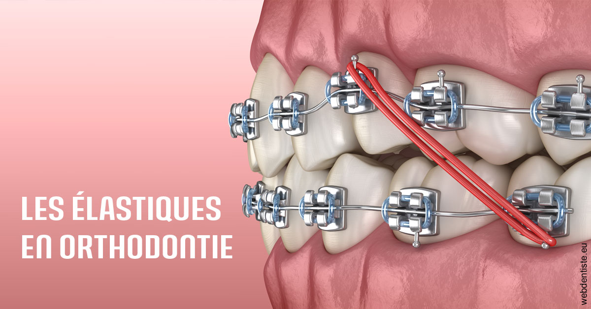 https://selarl-ercd.chirurgiens-dentistes.fr/Elastiques orthodontie 2