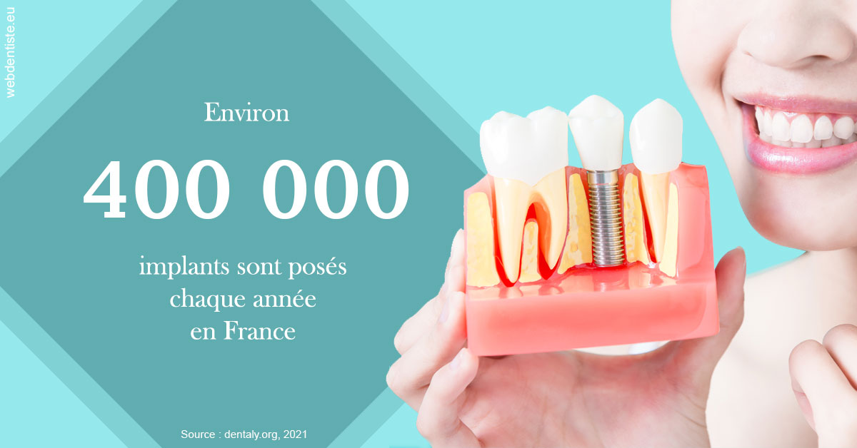 https://selarl-ercd.chirurgiens-dentistes.fr/Pose d'implants en France 2